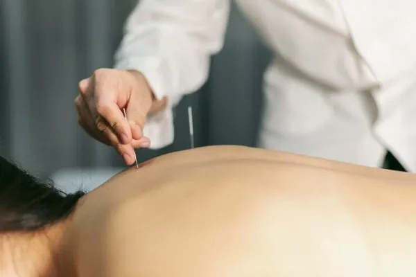 samudra naturopathy Acupuncture